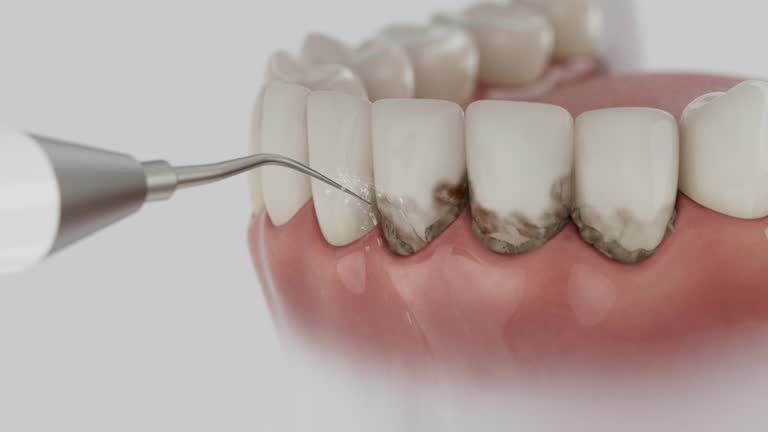 Trusted Dental Implants service in Pagedale, MO - Dentist Open Now